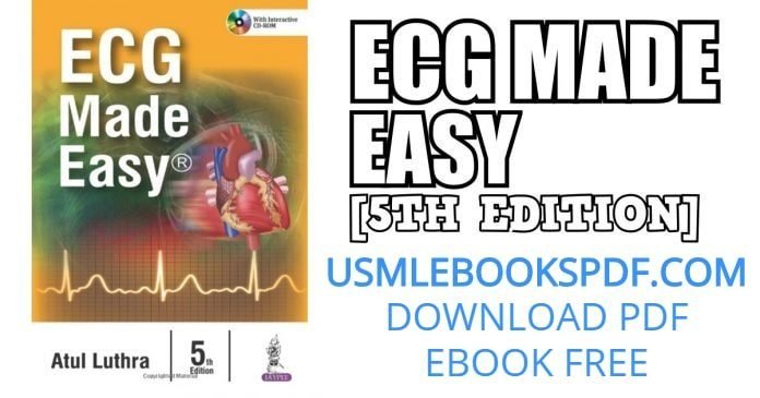 ecgs made easy pdf download