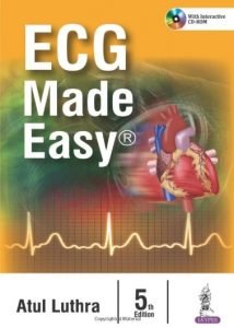 ecg made easy pdf