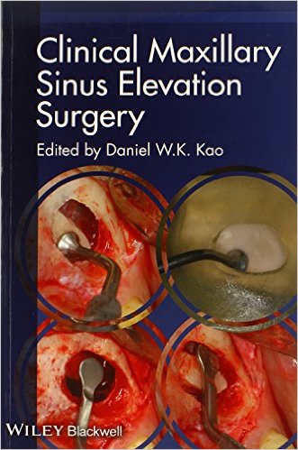 clinical-maxillary-sinus-elevation-surgery-pdf-min