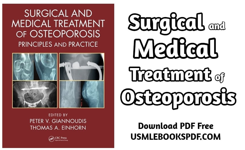 hesi case study medical surgical osteoporosis