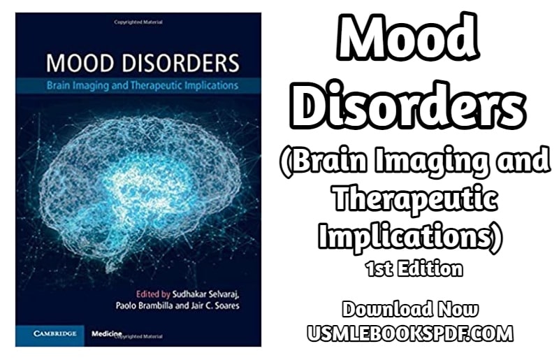 Mood Disorders (1)-min