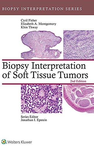 Biopsy Interpretation of Soft Tissue Tumors 2nd Edition PDF Download (Direct Link)